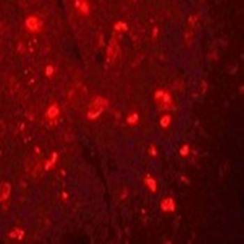 NALP6 Rabbit Polyclonal Antibody