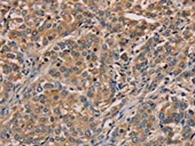 NANOS2 Antibody