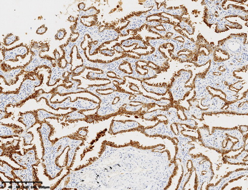 NAPSIN A Antibody