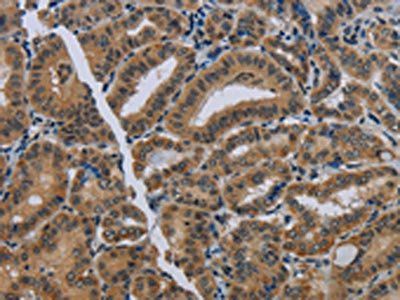 NAT10 Antibody