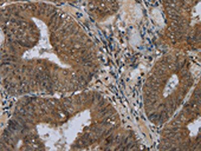 NAT10 Antibody