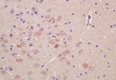SCN5A/Nav1.5 Rabbit Polyclonal Antibody