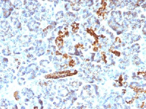 NCAM1 Antibody