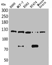 NCAM1 Antibody