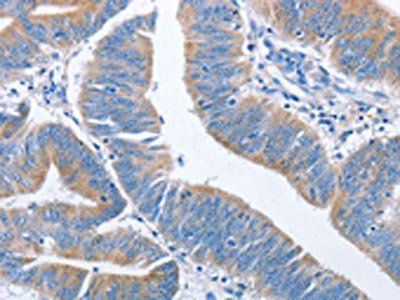 NCAPD2 Antibody