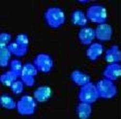 Nucleolin (Marker of Human Cells) Antibody