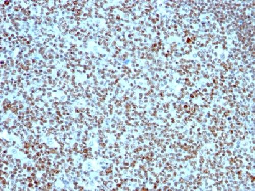 NCL Antibody