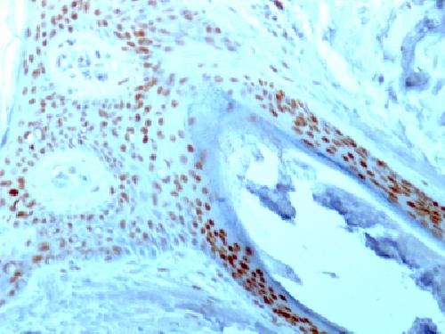 NCL Antibody
