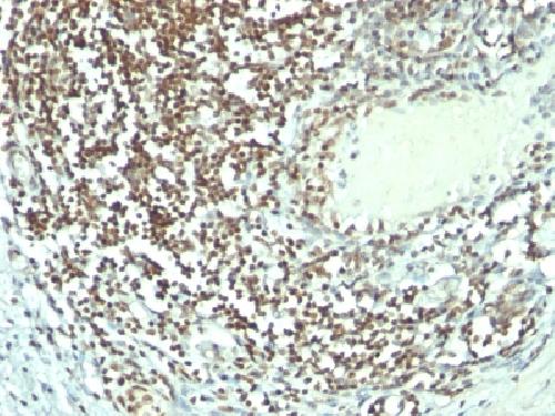 NCL Antibody