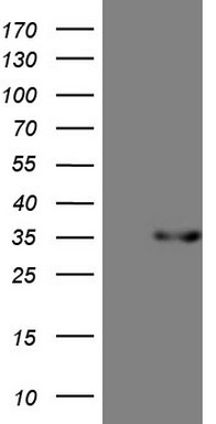 NCOA2 Antibody