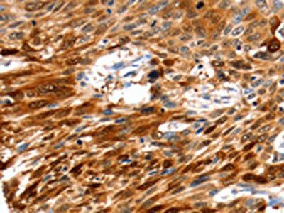 NCOR1 Antibody