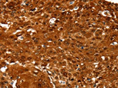 NCOR1 Antibody