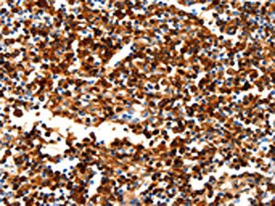 NCOR1 Antibody