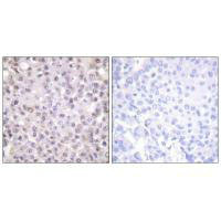 NCOR1 Antibody