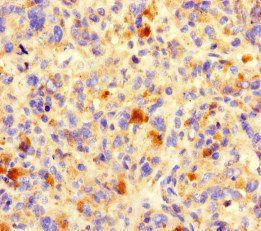 NCR3LG1 Antibody
