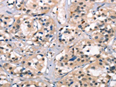 NSMCE3 Antibody
