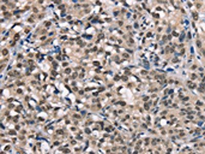 NSMCE3 Antibody