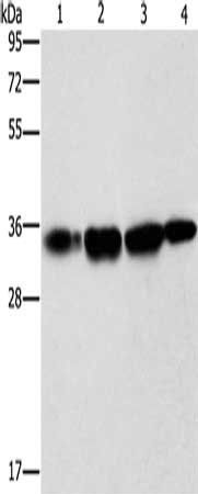 NSMCE3 Antibody