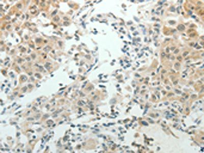 NDRG2 Antibody