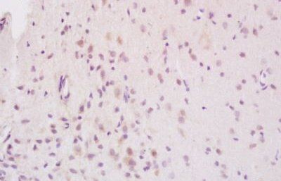 NDRG3 Rabbit Polyclonal Antibody