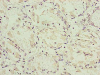 NDUFA12 Antibody