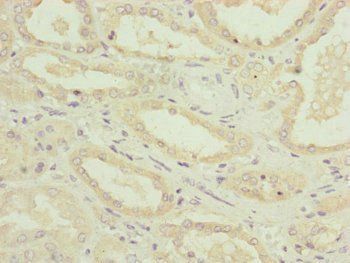 NDUFA12 Antibody