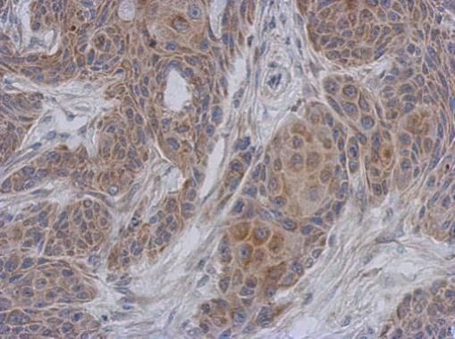 NADH:ubiquinone oxidoreductase subunit A12 Antibody