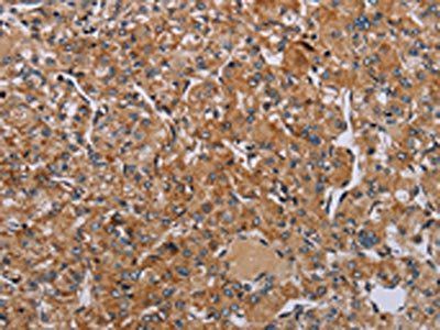 NDUFA8 Antibody