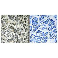 NDUFA8 Antibody