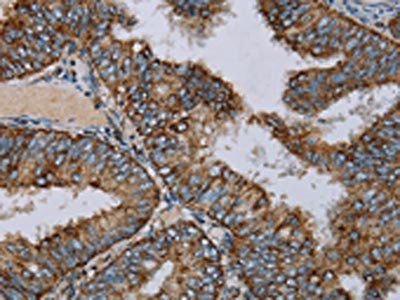 NDUFA9 Antibody