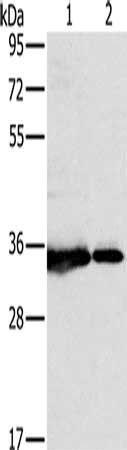 NDUFAF1 Antibody