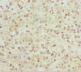 NDUFS1 Antibody