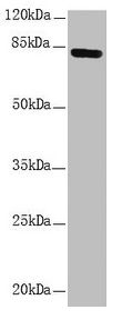 NDUFS1 Antibody