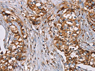 NDUFS1 Antibody