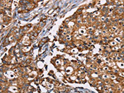NDUFS1 Antibody
