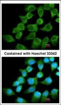 NADH:ubiquinone oxidoreductase core subunit S1 Antibody