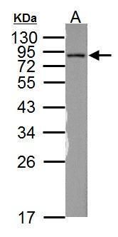 NADH:ubiquinone oxidoreductase core subunit S1 Antibody