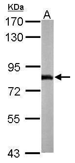 NADH:ubiquinone oxidoreductase core subunit S1 Antibody