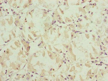 NDUFS6 Antibody