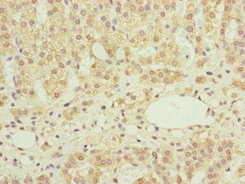 NDUFS6 Antibody