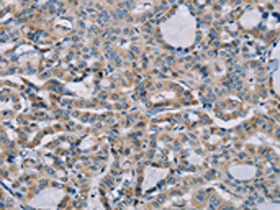 NDUFS7 Antibody