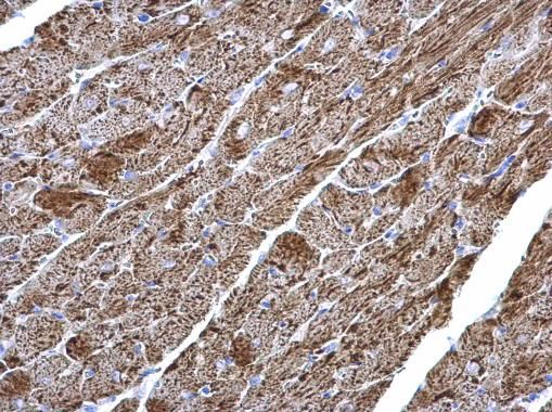 NDUFV2 Rabbit Polyclonal Antibody
