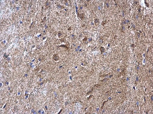 NDUFV2 Rabbit Polyclonal Antibody