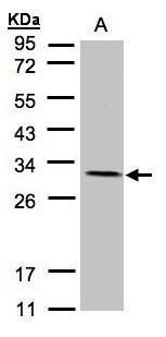 NDUFV2 Rabbit Polyclonal Antibody