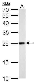 NDUFV2 Rabbit Polyclonal Antibody