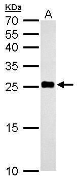 NDUFV2 Rabbit Polyclonal Antibody