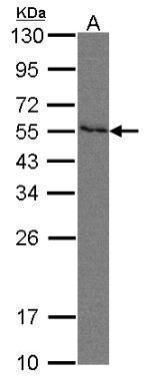 INPP1 Rabbit Polyclonal Antibody