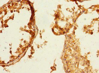 NECTIN3 Antibody