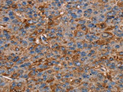 NEDD4L Antibody
