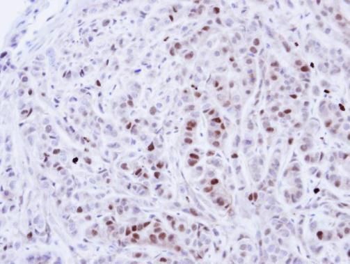 NIMA related kinase 4 Antibody
